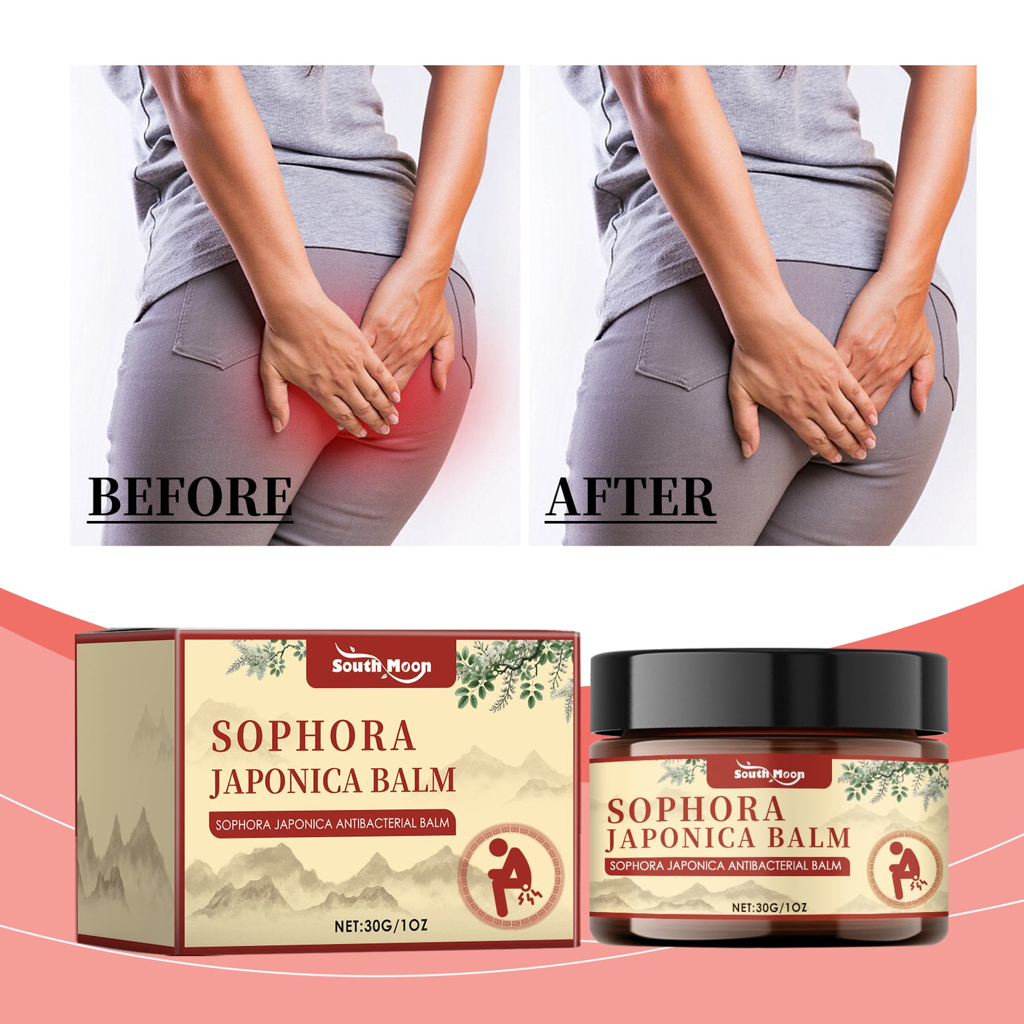 South Moon Hemorrhoid Ointment for Repairing swelling and itching of the anus, eliminating the inner and outer mixed moles, and relieving pain 1 pcs-ZLL
