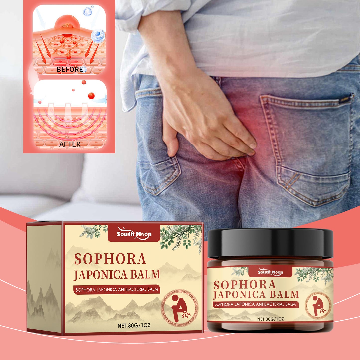 South Moon Hemorrhoid Ointment for Repairing swelling and itching of the anus, eliminating the inner and outer mixed moles, and relieving pain 1 pcs-ZLL